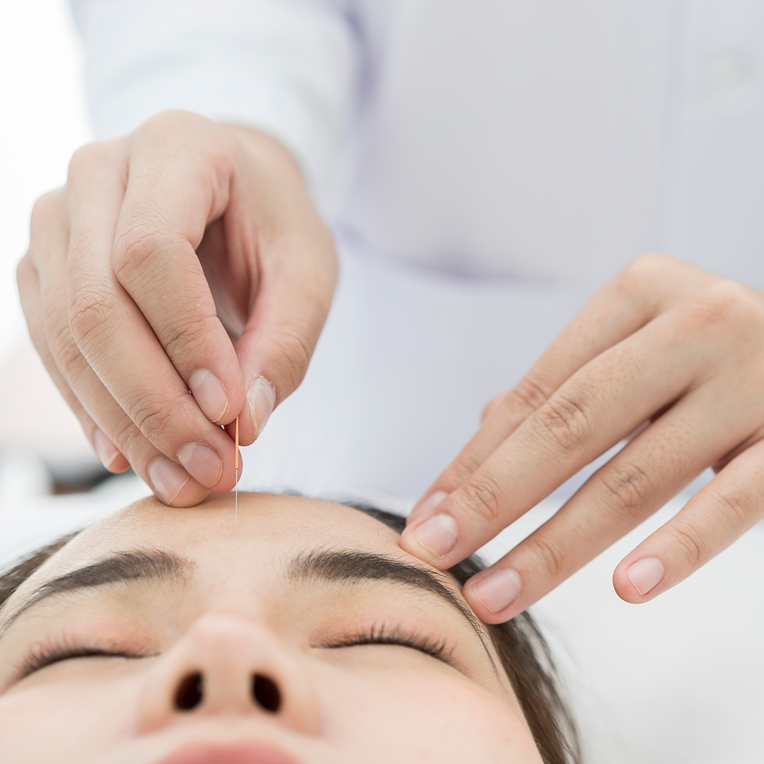 Raffles TCM Facial Rejuvenation Package